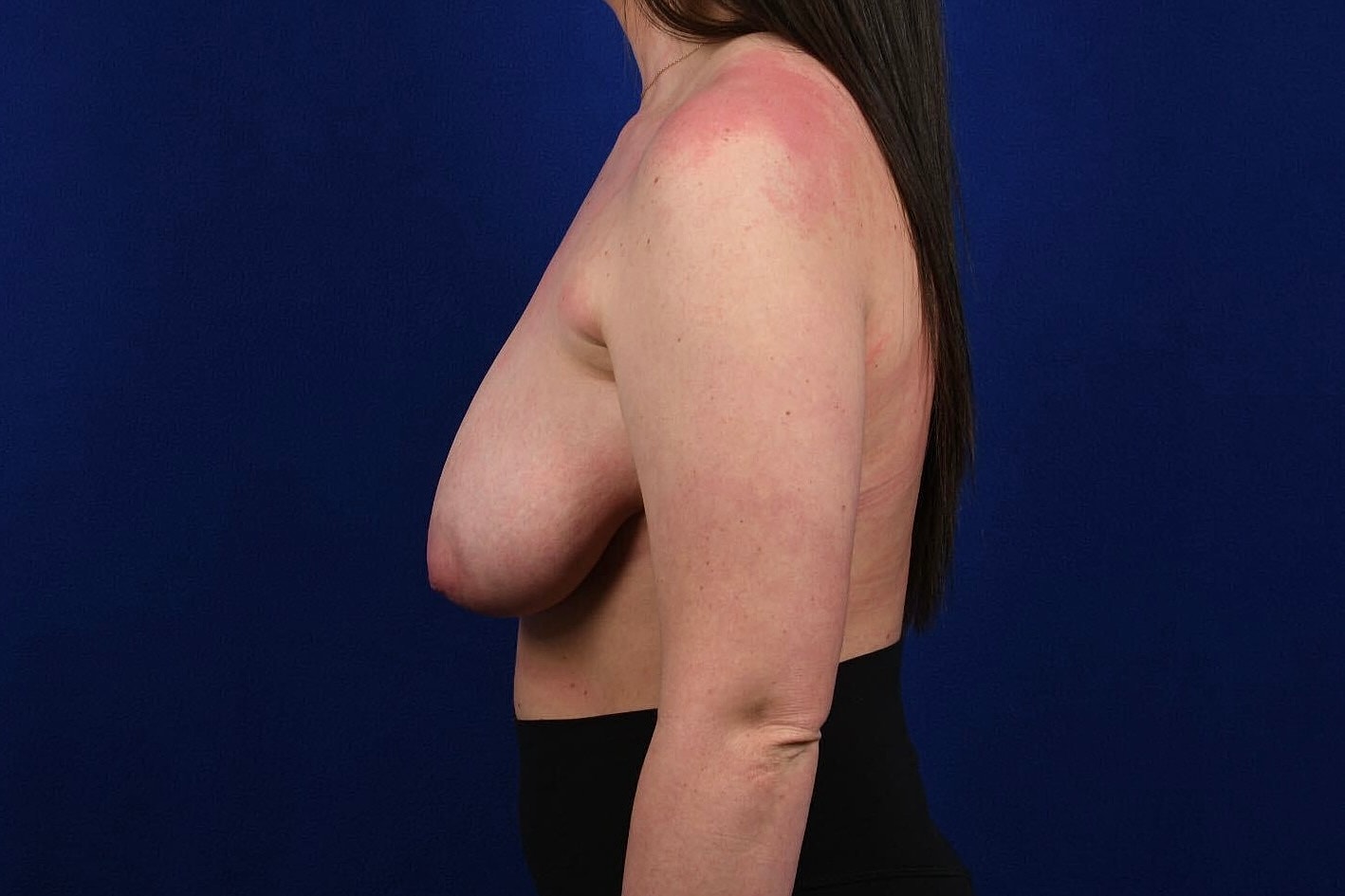 Side profile of a woman with exposed shoulder.