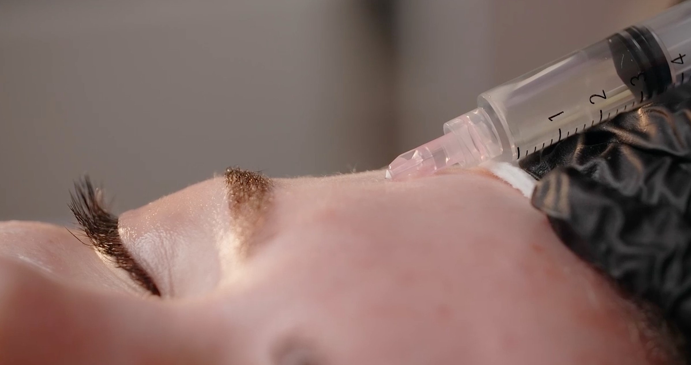Injecting substance into skin near eyebrow.